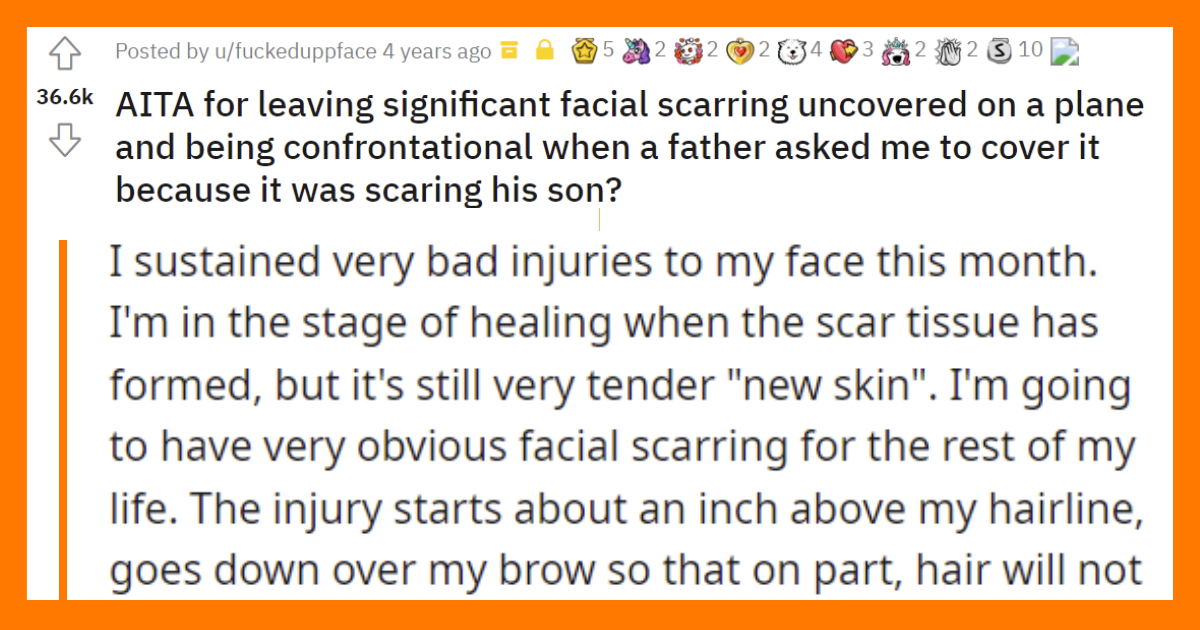 AITA-for-leaving-significant-facial-scarring-uncovered on-a-plane